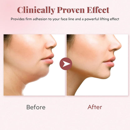 Face Strap