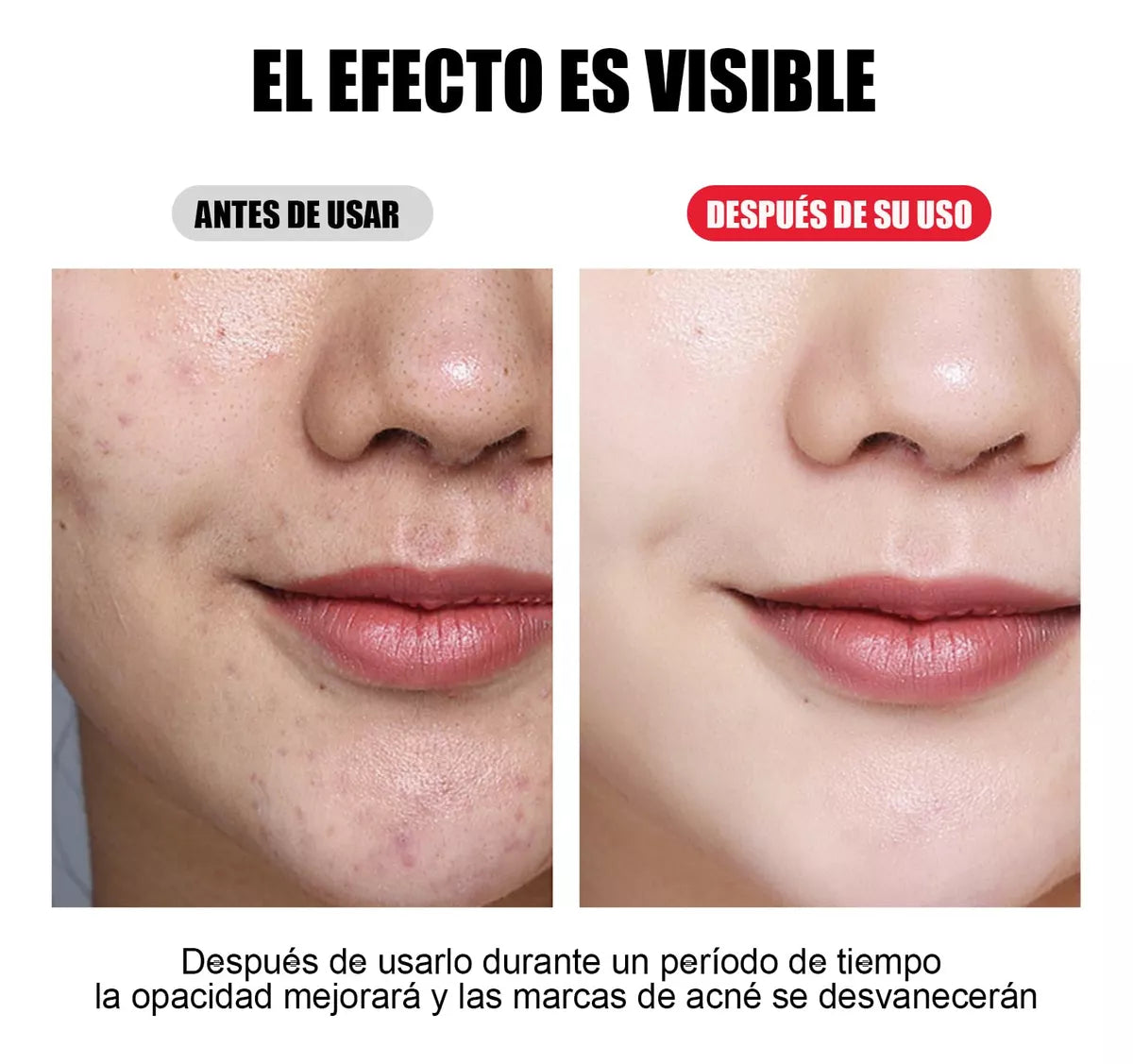 Mascara LED Fototerapia