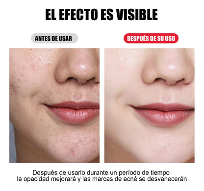 Mascara LED Fototerapia